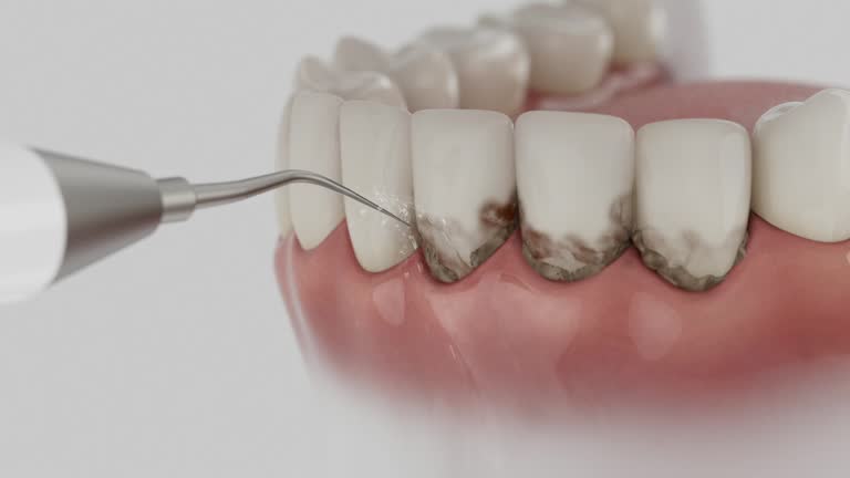 Trusted Teeth Cleaning And Checkup service in Gatlinburg, TN - Dentist Open Now